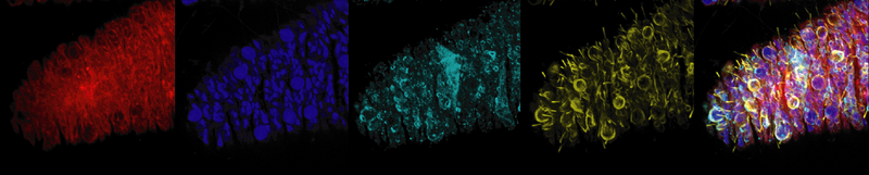 Composite fluorescence microscopy image showing tissue stained with multiple fluorescent markers, including separate color channels and a merged overlay highlighting cellular structures.